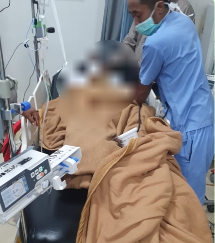 Laka Tunggal di Jalan Ahmad Yani, Korban Luka Berat Akibat Bentukan di Kepala